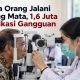 34 Juta Orang Jalani Skrining Mata, 1,6 Juta Terindikasi Gangguan